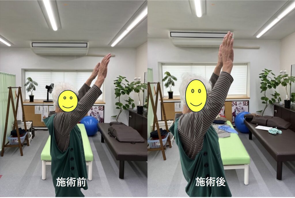 ✨昨日の施術の一場面をご紹介します✨