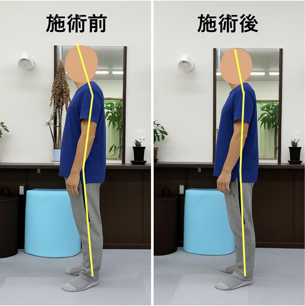 【施術レポ】🧍♂️40代男性 首・背中・腰の痛みでご来店