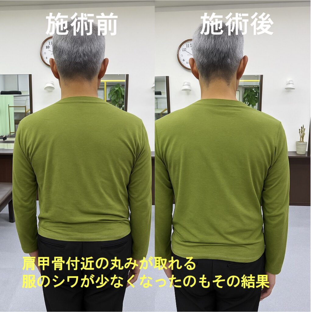 【施術レポ】🌙夜に開いててよかった!背中の張りがスッキリ!