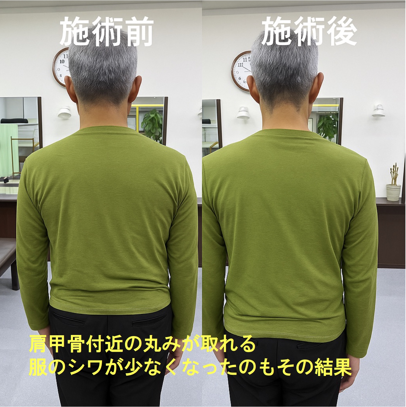 【施術レポ】🌙夜に開いててよかった！背中の張りがスッキリ！