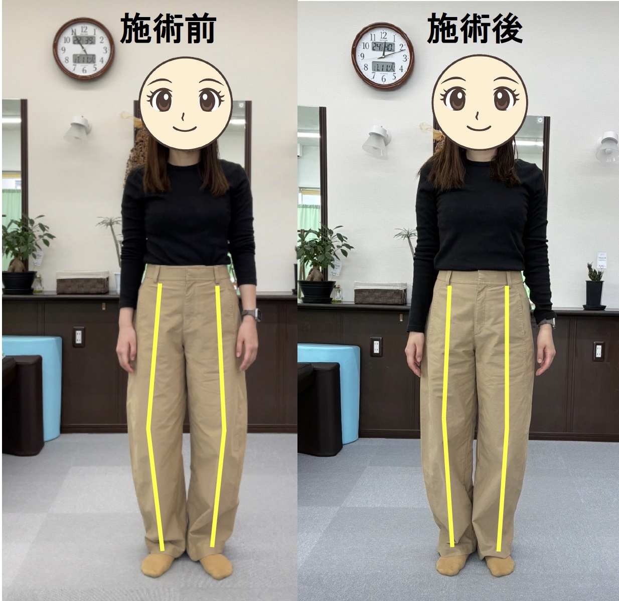 【施術レポ】✨首・肩の重だるさ＆O脚改善✨ 〜姿勢が変わるとカラダも軽くなる〜